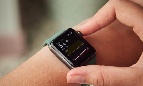 Photo of smart watch showing blood sugar levels