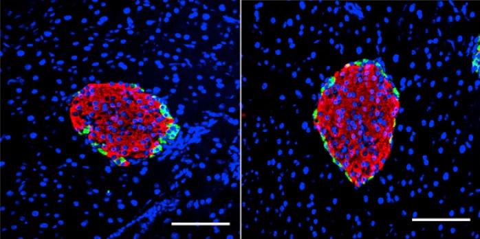 Microscope image of pancreatic islets stained with dye to make them more easy to see