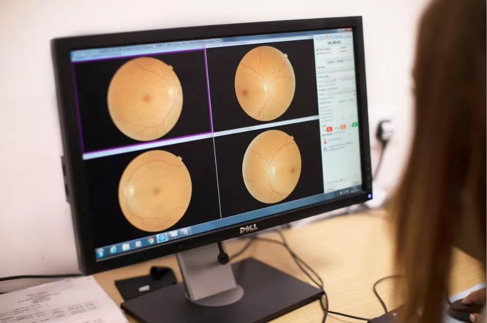 A healthcare professional looking at photos from a retinopathy screen